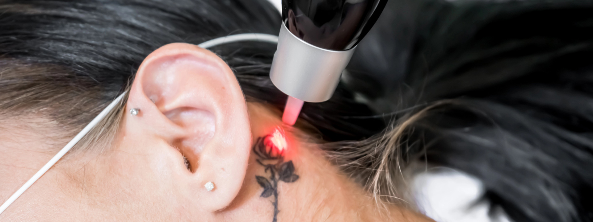 A beautiful woman is receiving a tattoo removal treatment.