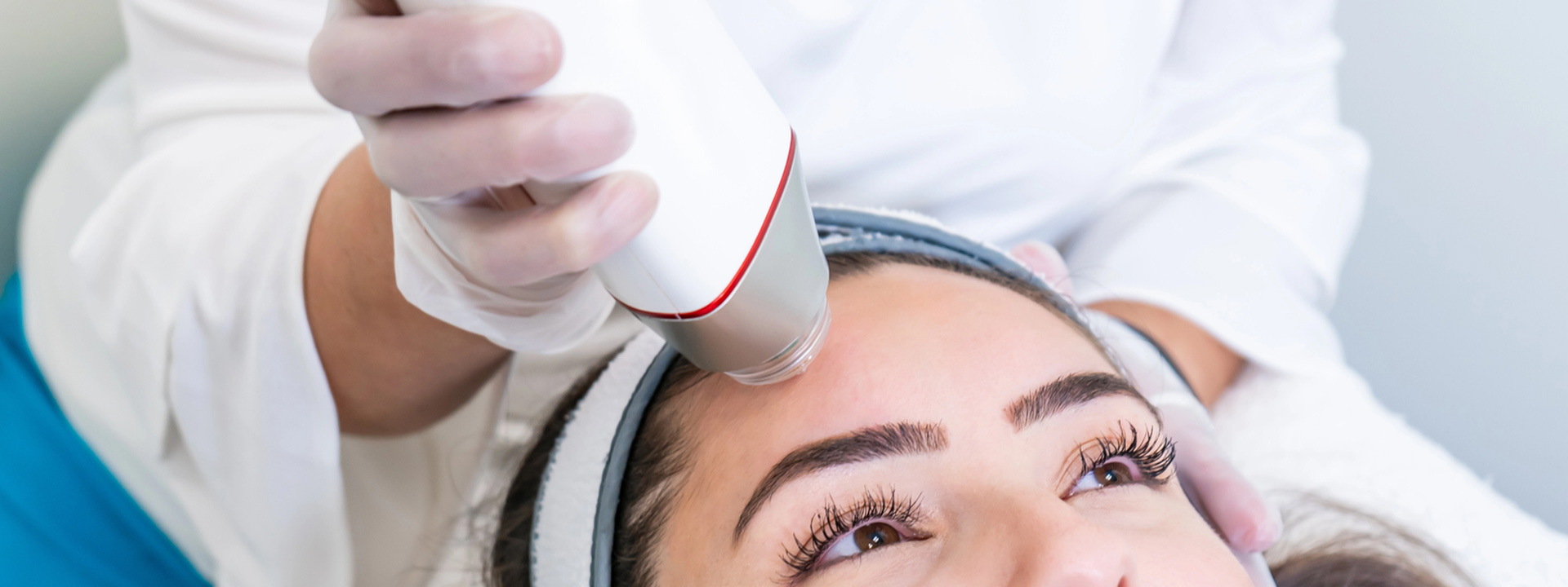 A beautiful woman receiving RF microneedling treatment.